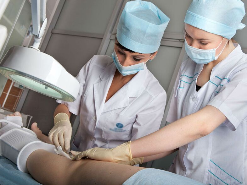 Ablación con láser para varices